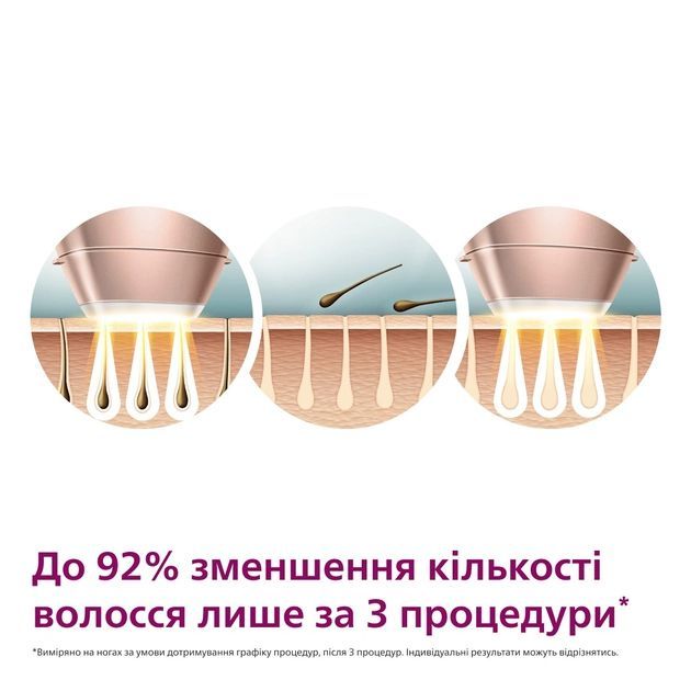 Фотоепілятор Philips Lumea IPL 9900 Series, акумуляторний , кіл-ть спалах.-450000, 2- 4 см2, насадок-4, футляр, рожевий